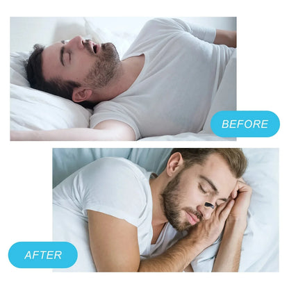 30-Day Magnetic Nasal Breathing Dilator Kit – Improve Sleep, Reduce Snoring & Boost Airflow
